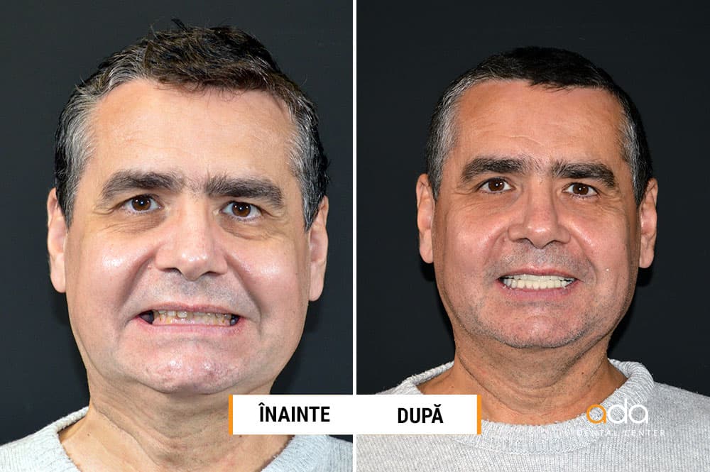 DSD oferă soluțiile corecte — imagine 1
