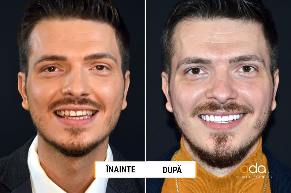 DSD — Calitate ușor accesibilă — imagine 1