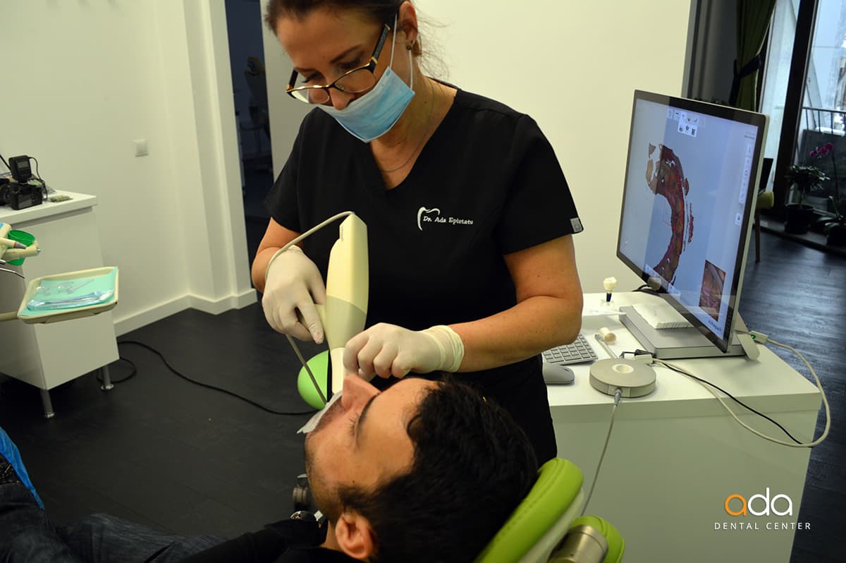 Coroane zirconiu — imagine din tratament, Smile by Ada, Sector 2 București — foto 3