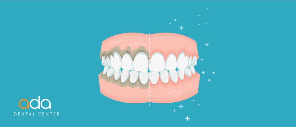 Importanta Digital Smile Design in parodontologie
