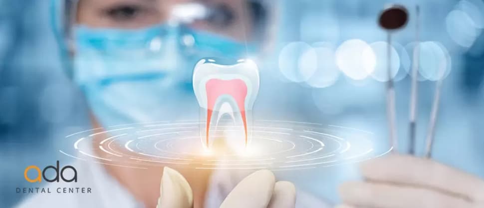 Implantologia digitalizată: avantaje, etape ale procedurii