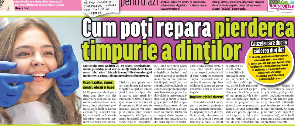 Implantul dentar și boala parodontală