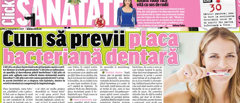 Implant dentar: cât rezistă, care sunt etapele și ce avantaje ai